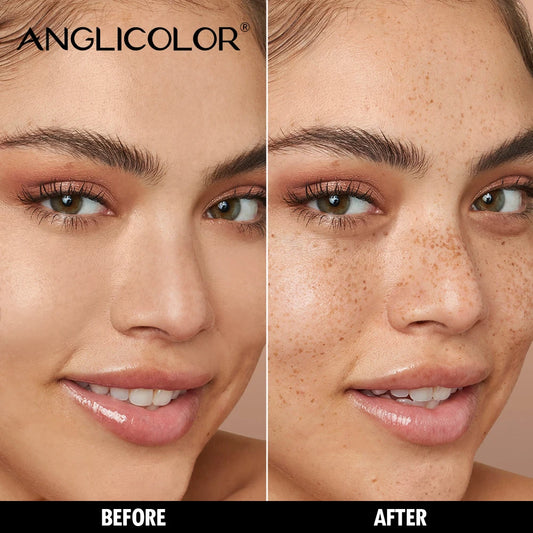 Original ANGLICOLOR Freckle Pen - 5-Prong Pen for a Naturally Radiant Freckle Effect